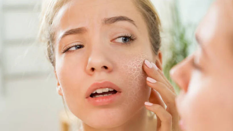 بررسی تمام روش های خانگی درمان خشکی پوست صورت + نکات تغذیه ای مهم!
